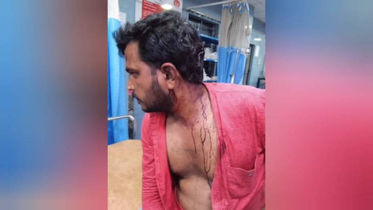 இருவரை  வெட்டிய திமுக பிரமுகர்- வழக்கு பதிவு செய்ய மறுக்கும் காவல்துறை!