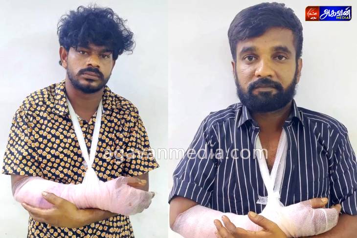 நாய் குறுக்கே வந்ததால்தான்... குற்றவாளிகள் கை உடைந்தது - போலீசார் தகவல்!

