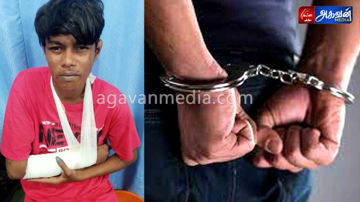 வழிப்பறியில் ஈடுபட்ட ரவுடி கைது: தப்பிக்கும் போது விபத்தில் கை முறிவு!